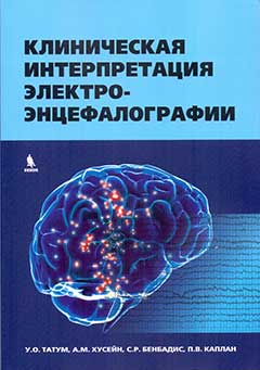 Клиническая интерпретация электроэнцефалографии