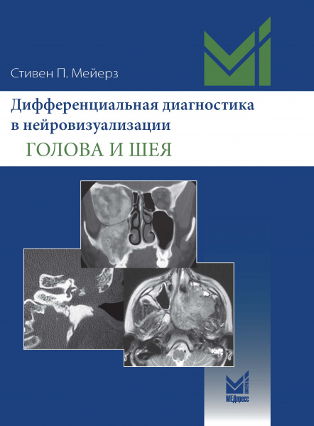 Мейерз3