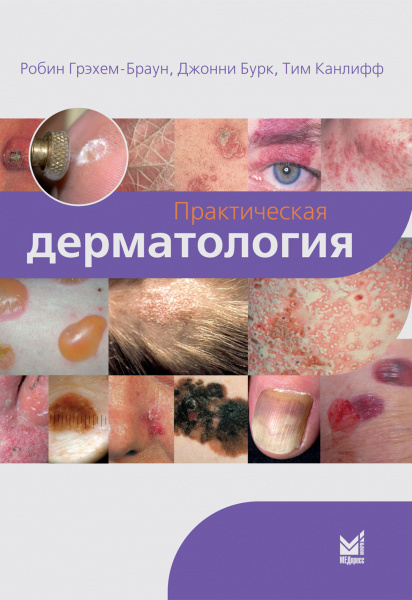 439_Prakticheskaja_dermatologija_nGraham-Brouna