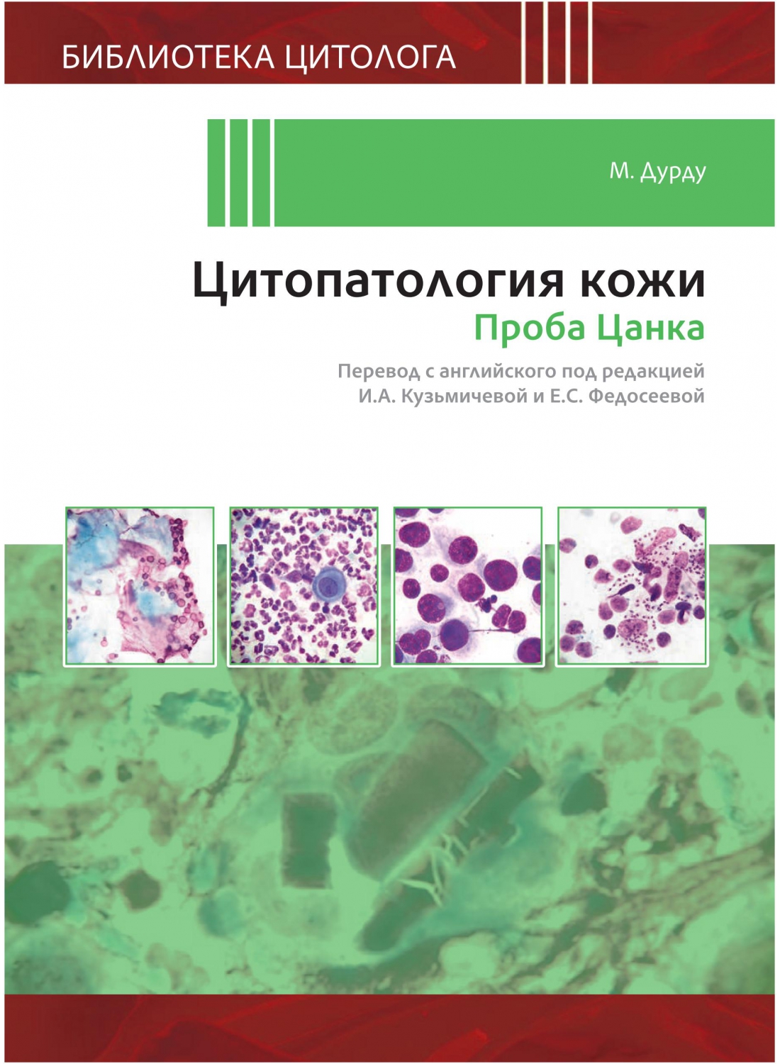 citopatkozhi_1-1100x1500