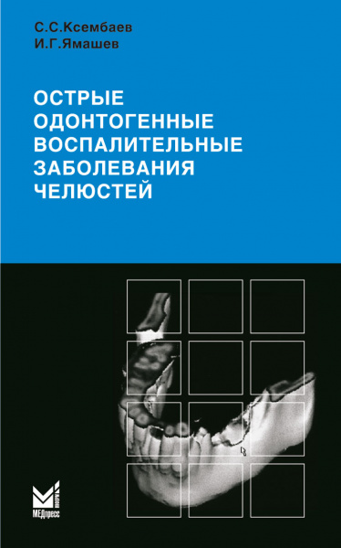 152_Ostrye_odontogennye_vospalitelprnye_zabolevanija_cheljustejoKsembaevd