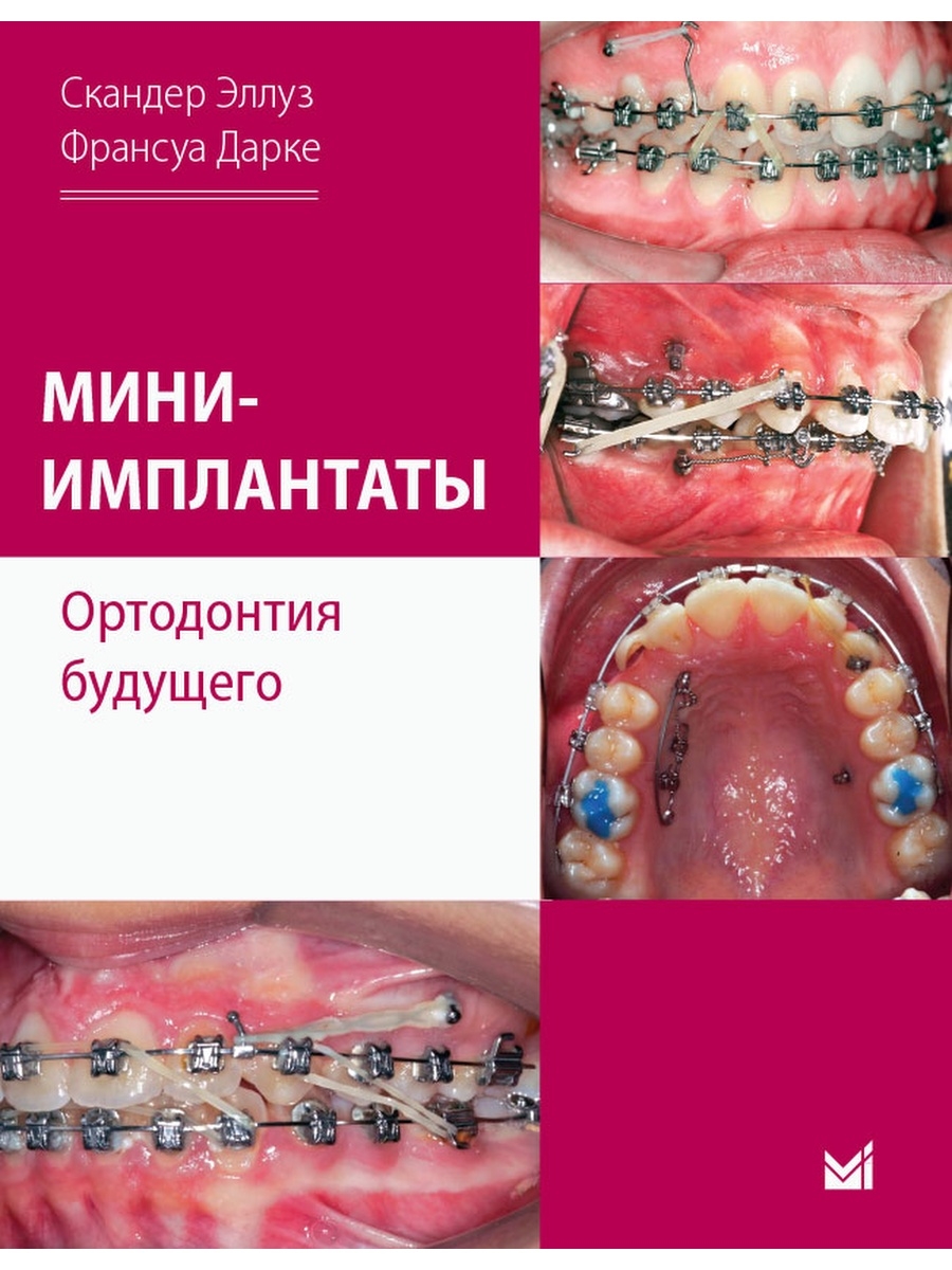 65490217-1