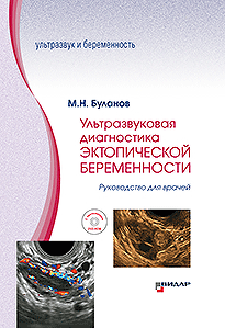 Ультразвуковая диагностика эктопической беременности