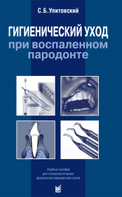 Гигиенический уход при воспаленном пародонте