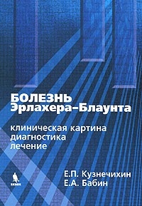 Болезнь Эрлахера-Блаунта