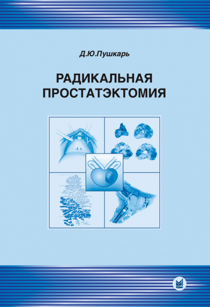 094_Radikalqonaja_prostatjektomijahPushkarbwc