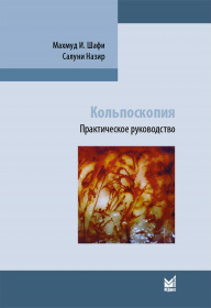 Кольпоскопия.