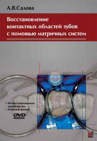 Восстановление контактных областей зубов с помощью матричных систем