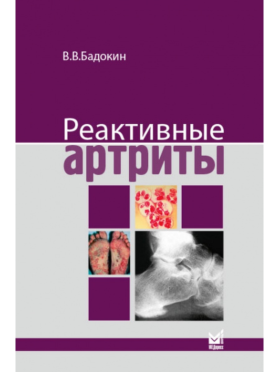 86113854-1