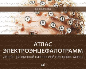 Атлас электроэнцефалограмм детей с различной патологией головного мозга