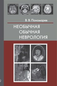 Необычная обычная неврология