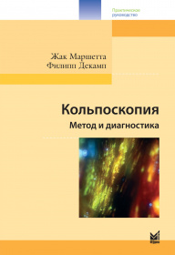 Кольпоскопия