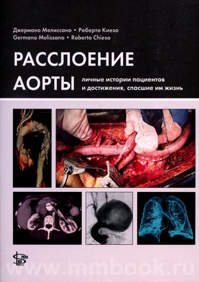 Расслоение