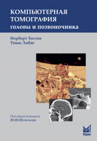Компьютерная томография головы и позвоночника Компьютерная томография головы и позвоночника