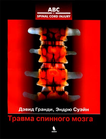 travma-spinnogo-mozga-grundy-swain-350a