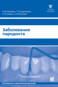 Заболевания пародонта