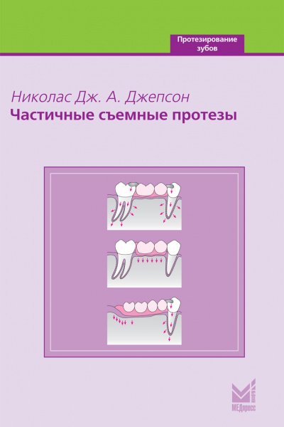 032_Chastichnye_szemnye_protezyuDzhepsonp
