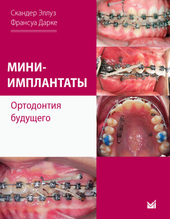 0dbd35b6a7d5a178ee405b55879abacc.jpg