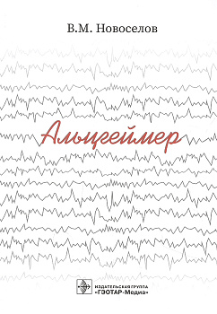 Альцгеймер 