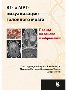 КТ- и МРТ- визуализация головного мозга. Подход на основе изображений КТ- и МРТ- визуализация головного мозга. Подход на основе изображений