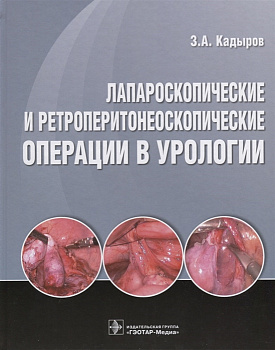 Лапароскопические ретроперитонеальные операции в урологии