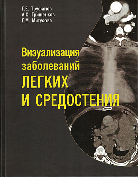 Визуализация заболеваний легких и средостения