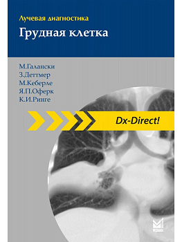 Лучевая диагностика. Грудная клетка Лучевая диагностика. Грудная клетка