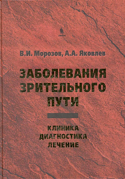 Заболевания зрительного пути