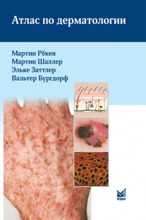 478_Atlas_po_dermatologiizRekenp