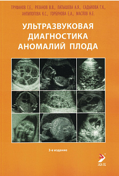 Ультразвуковая диагностика аномалий плода