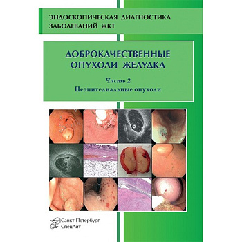 Доброкачественные опухоли желудка. Часть 2