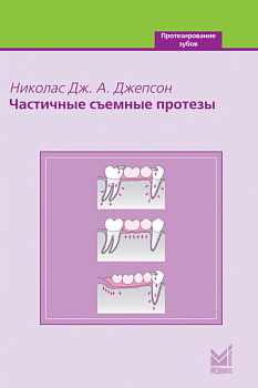 Частичные съемные протезы