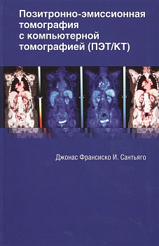 Позитронно-эмиссионная томография с компьютерной томографией(ПЭТ/КТ)