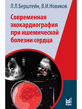 Современная эхокардиография при ишемической болезни сердца