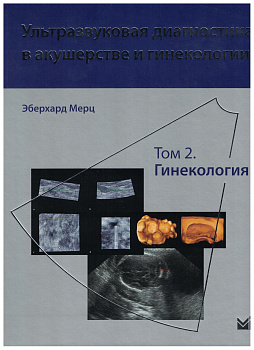 Ультразвуковая диагностика в акушерстве и гинекологии. Т.2. Гинекология
