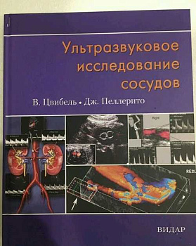 Ультразвуковое исследование сосудов