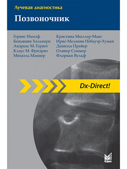 Лучевая диагностика. Позвоночник