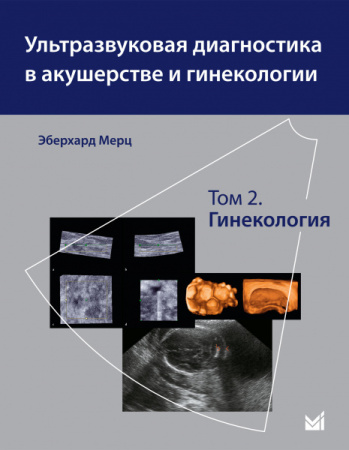 256_Ulurtrazvukovoe_issledovanie_v_akusherstve_i_ginekologii_tom_2zMercb