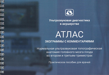 Атлас эхограммы с комментариями