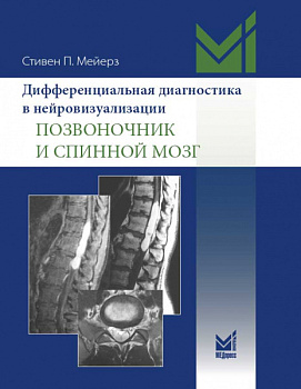 Дифференциальная диагностика в нейровизуализации. Позвоночник и спинной мозг