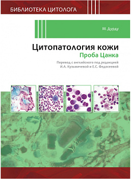 Цитопатология кожи. Проба Цанка