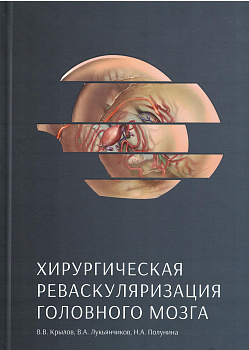 Хирургическая реваскуляризация головного мозга. Хирургическая реваскуляризация головного мозга.