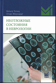Неотложные состояния в неврологии