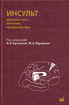 Инсульт: диагностика, лечение, профилактика