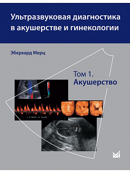 Ультразвуковая диагностика в акушерстве и гинекологии. Т.1. Акушерство