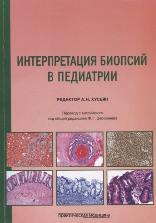 9122
