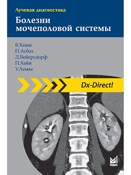 Лучевая диагностика. Болезни мочеполовой системы.