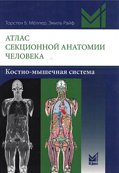 Атлас секционной анатомии человека. Костно-мышечная система