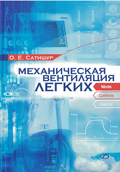 Механическая вентиляция легких