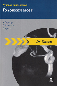 Лучевая диагностика. Головной мозг. Лучевая диагностика. Головной мозг.